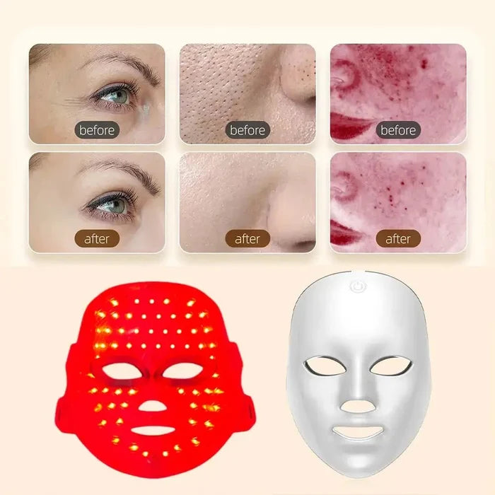 Fernglow 7-Color LED Light Therapy Mask